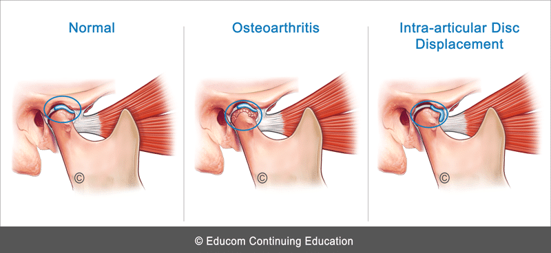 TMJ-Clinical-Tips